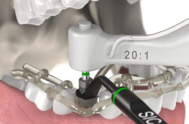 Dental-Implantology-Guided-Surgery-Animation-SICace-implant-insertion
